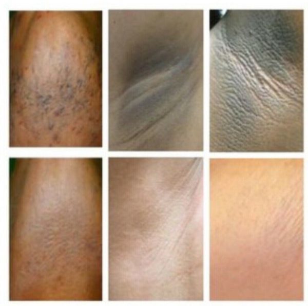 Dark Skin Whitening Dark spot Brightening Bleaching Lightening Face body Cream - Image 2