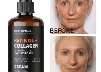 Retinol + Collagen, Hyaluronic Acid, Vitamin C AntiAging Wrinkle Serum Cream 4oz