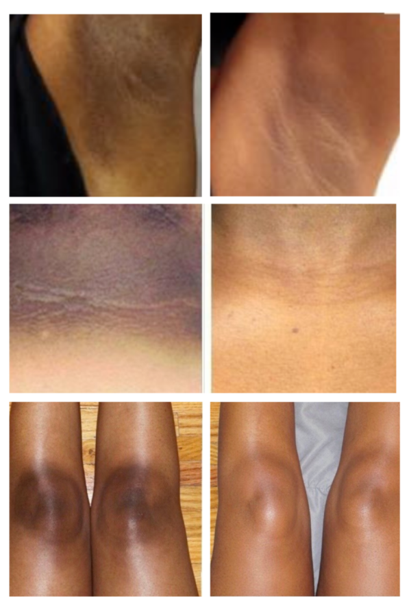 Dark Skin Whitening Dark spot Brightening Bleaching Lightening Face body Cream - Image 3