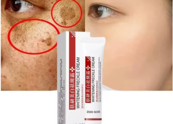 Effective Whitening Freckle Cream Remove Dark Spot Cream Removal Melanin Melasma